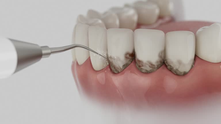 Trusted Dental Crowns And Bridges service in Boonville, MO - Dentist Open Now
